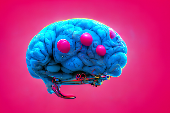 Brain #174