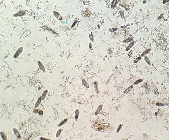 Demodex gatoi enlarged 100x #original