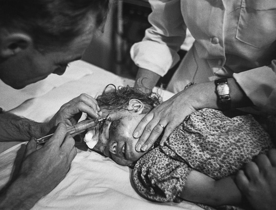 Country Doctor - Dr. Ernest Ceriani Giving Injection to Girl Kicked by Horse