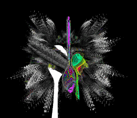 multi:versal glimpx$xe