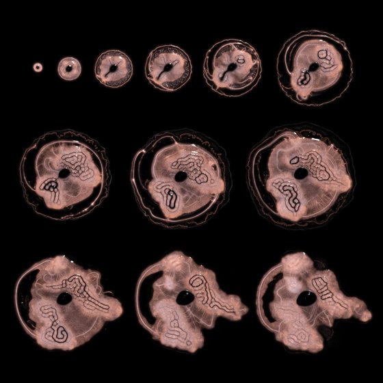 Embryogenesis #89